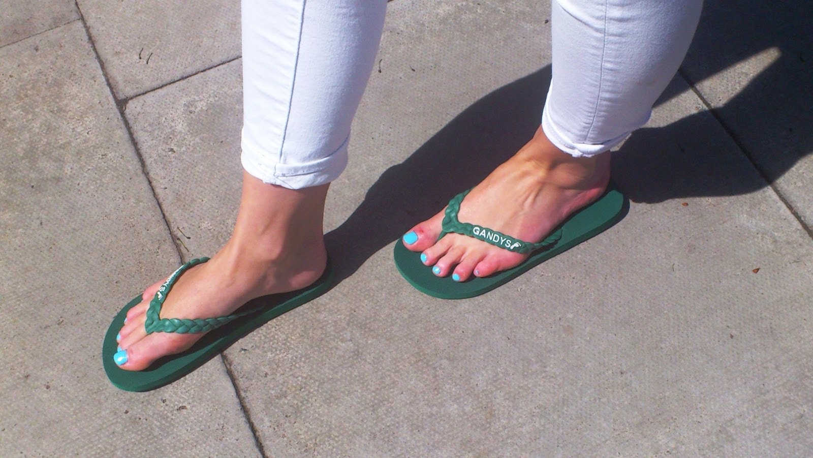 Problems Linked with Extensor Tendonitis Flip Flops Overuse