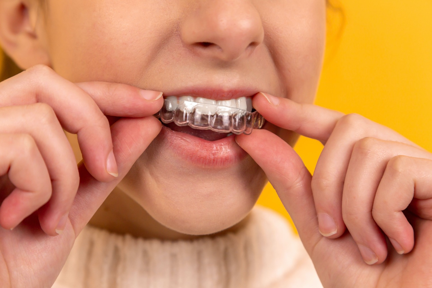 What is the Right Time or Age for Braces?