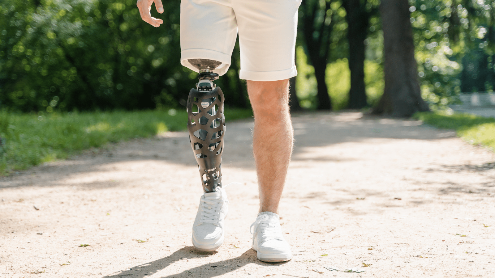 Custom Prosthetic Leg